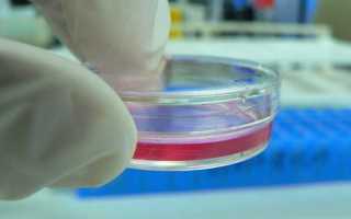 Что такое бакпосев в урологии