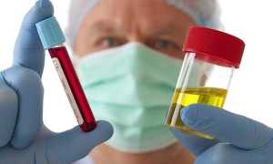 Лабораторные анализы в урологии