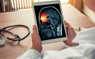 Очень сильно болит голова мигрень