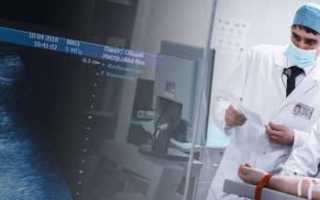 Урология лопаткина мочекаменная болезнь — Болезни почек-гломерулонефрит