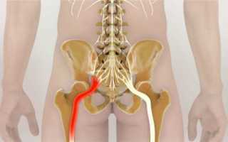 Не могу ходить болит нижняя часть спины