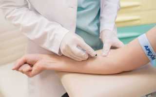 Лабораторные анализы в урологии