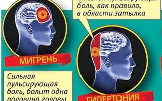 Болит правая сторона головы пульсирующая боль