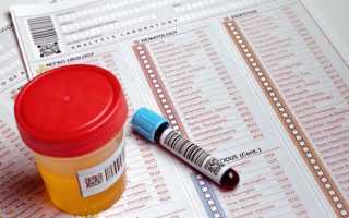 Какие анализы сдают при простатите