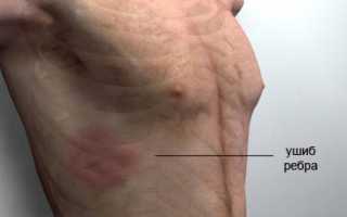 Что может болеть в правом боку под ребром отдает в спину