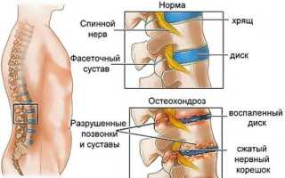 Болит спина и нога это нервы