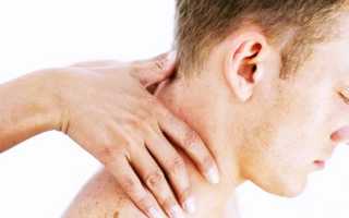 Что за болезнь если каждый день болит голова