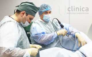 Сколько стоит раздробить камни в почках ультразвуком