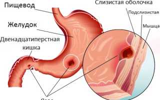Что может болеть в животе и отдавать в спину