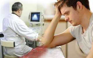 Чем отличается урологический массаж от массажа простаты