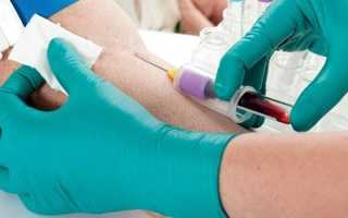 Проба Реберга — как правильно собирать и сдавать, что показывает анализ расшифровка