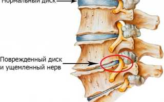 Почему болит спина лежа на спине