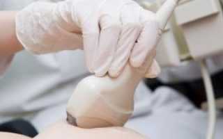 Двухкамерная киста левого яичника лечение. Что такое двухкамерная киста яичника и какое требуется лечение