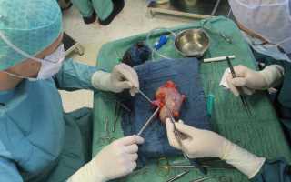 Отделение лечения почек — Почки и МКБ