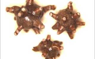 Ураты в моче у ребенка в большом количестве и соли: что это значит