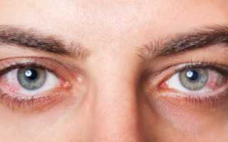 Лопнул сосуд в глазу болит голова что делать