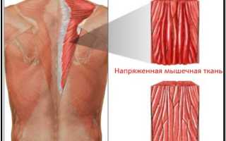 Болит спина протянуло сквозняком