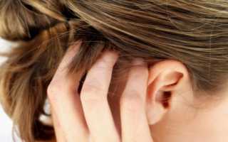 Болят корни волос на голове и выпадают волосы причины