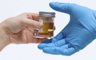 Общий анализ мочи: какие сроки выполнения, сколько дней делают. Анализ на стафилококк: как берут и где сдать анализ