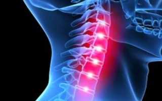 Если болит спина в области шеи