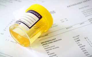 Урологические заболевания белок в моче