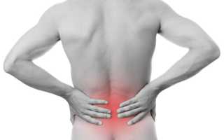 Болит спина в области поясницы причины у женщин отдает в ноги