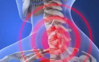 Болит шея около головы что это