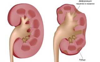 Количество бактерий в моче при анализе: норма, что означает большое количество бактерий в моче, лечение