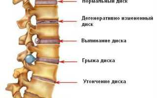 Жгет в области спины и болит