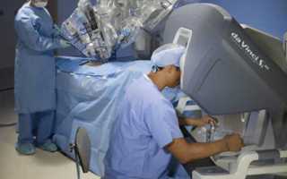 Операция роботом Да Винчи (da Vinci)