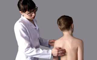 Болит спина у ребенка лечение