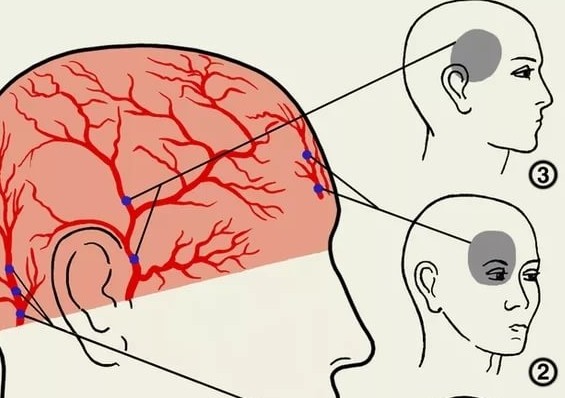 Несколько дней болит глаз и голова