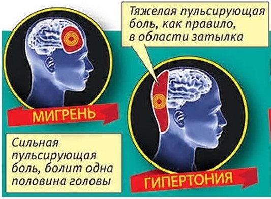 Болит правая сторона головы пульсирующая боль