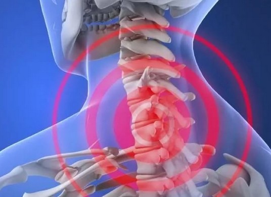 Болит шея около головы что это