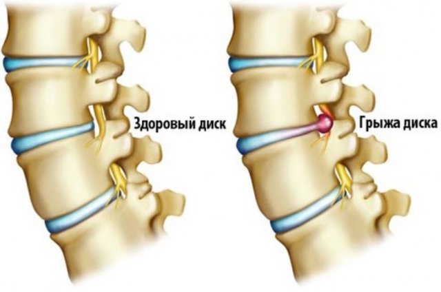 Больно дышать спина и сердце болит