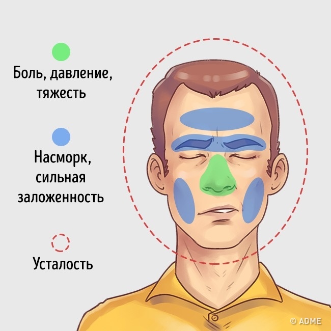 При сжимании челюсти болит голова