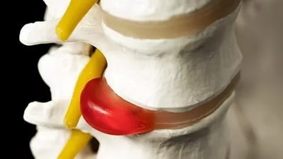 болит спина можно ли массаж