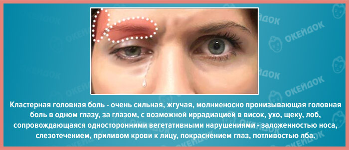 klasternaya-golovnaya-bol