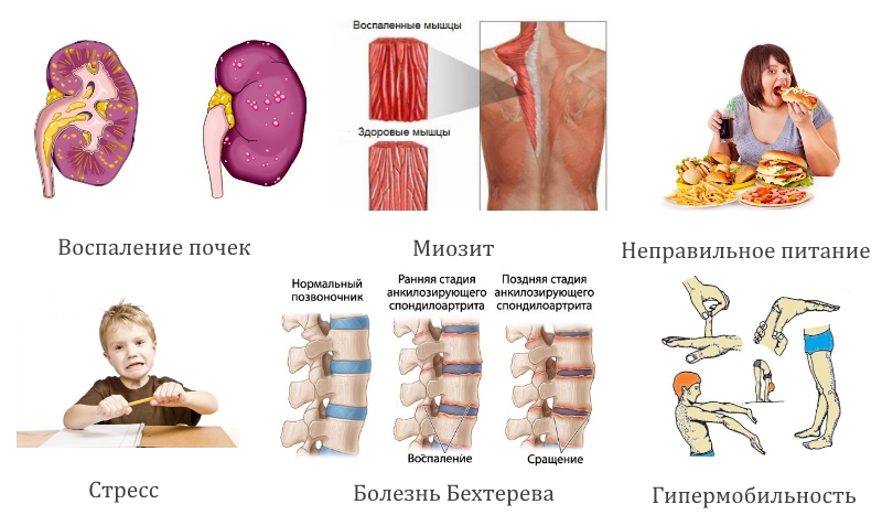 Частые причины боли в спине у детей