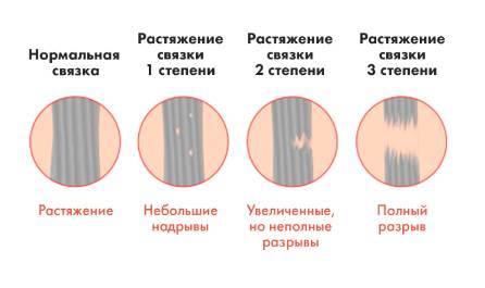 Болит спина занимаюсь спортом