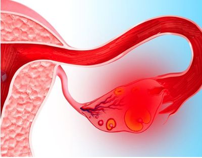 Перед и после месячных болит спина