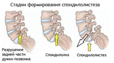 Болит сзади спины ночью