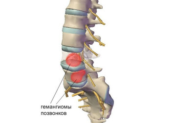 Больно дышать спина и сердце болит