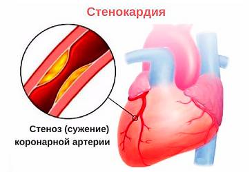 Больно дышать спина и сердце болит