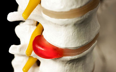 При глубоком вдохе болит спина и ребра