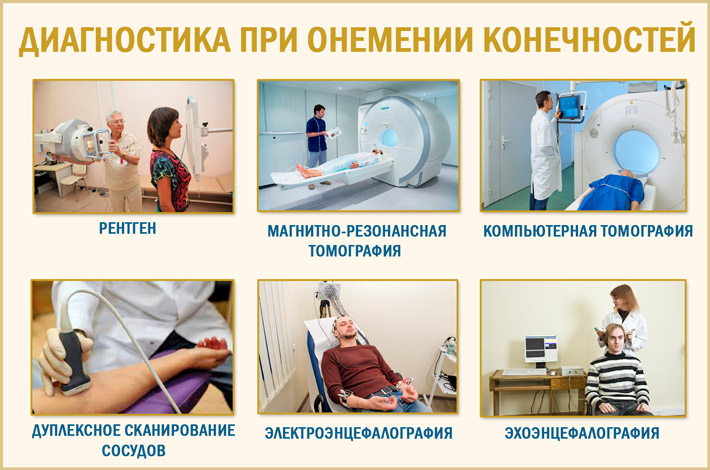 Диагностика онемения Определить причины онемения