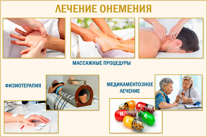 Лечение онемевших конечностей Лечение парестезии рук и ног