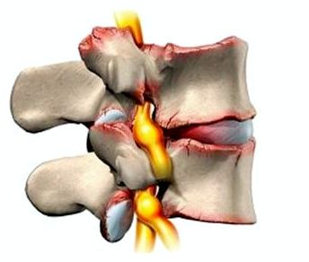 При глубоком вдохе болит спина и ребра