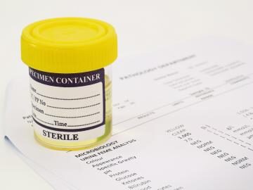 1518445105755d8e457ee02-96590422