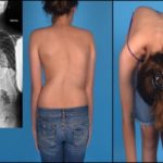 Болит грудная клетка отдает в спину что это может быть